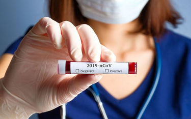 Synektik stawia na polskie testy na koronawirusa