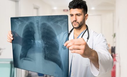 Rak płuca jest w Polsce pierwszą przyczyna śmierci osób cierpiących na choroby onkologiczne
