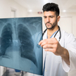 Rak płuca jest w Polsce pierwszą przyczyna śmierci osób cierpiących na choroby onkologiczne