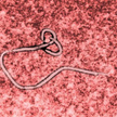 Niepozorna laseczka - wirus Ebola pod mikroskopem.