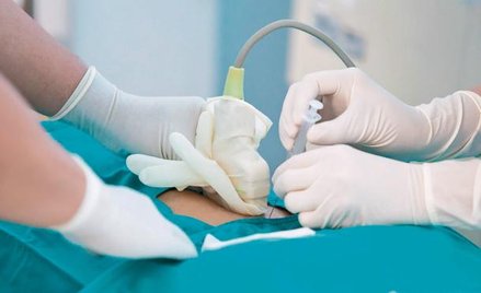 Pierwsze aminopunkcję przeprowadzano już w XIX. Jednak precyzyjnie można było ją przeprowadzić dopie