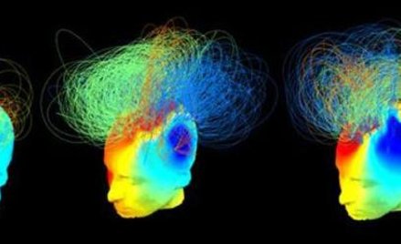 Z lewej strony i w środku pacjenci w stanie wegetatywnym. Ten w środku odpowiedział na „test tenisa”