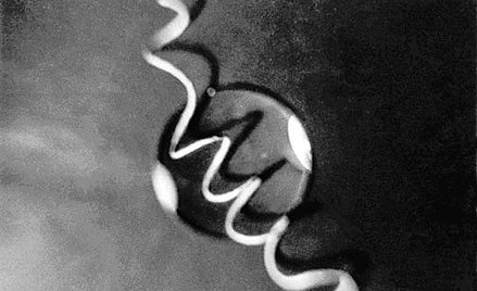 Odbitki, mistrzowie i paradoksy