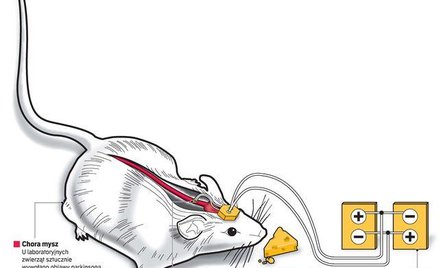 Nowa metoda leczenia jest stosunkowo mało inwazyjna i bardzo skuteczna