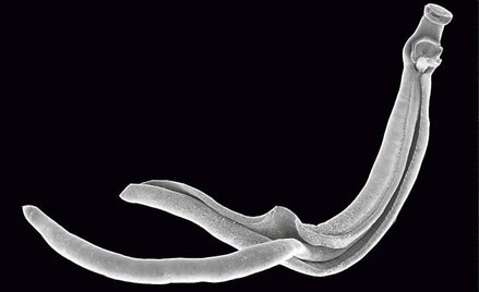 Przywry Schistosoma japonicum widoczne pod mikroskopem elektronowym
