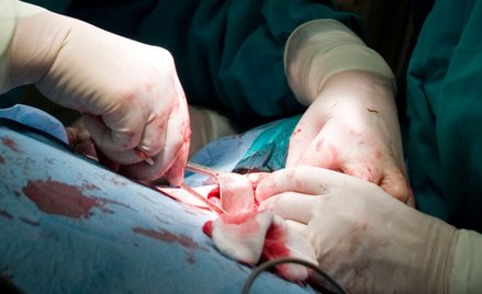 Robot pomoże polskim kardiochirurgom