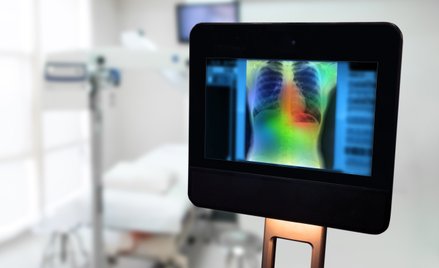 NHS testuje technologię, która skraca diagnozę raka płuca z tygodni do jednego badania