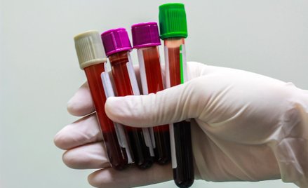 Rak krwi: liczba chorych na świecie rośnie