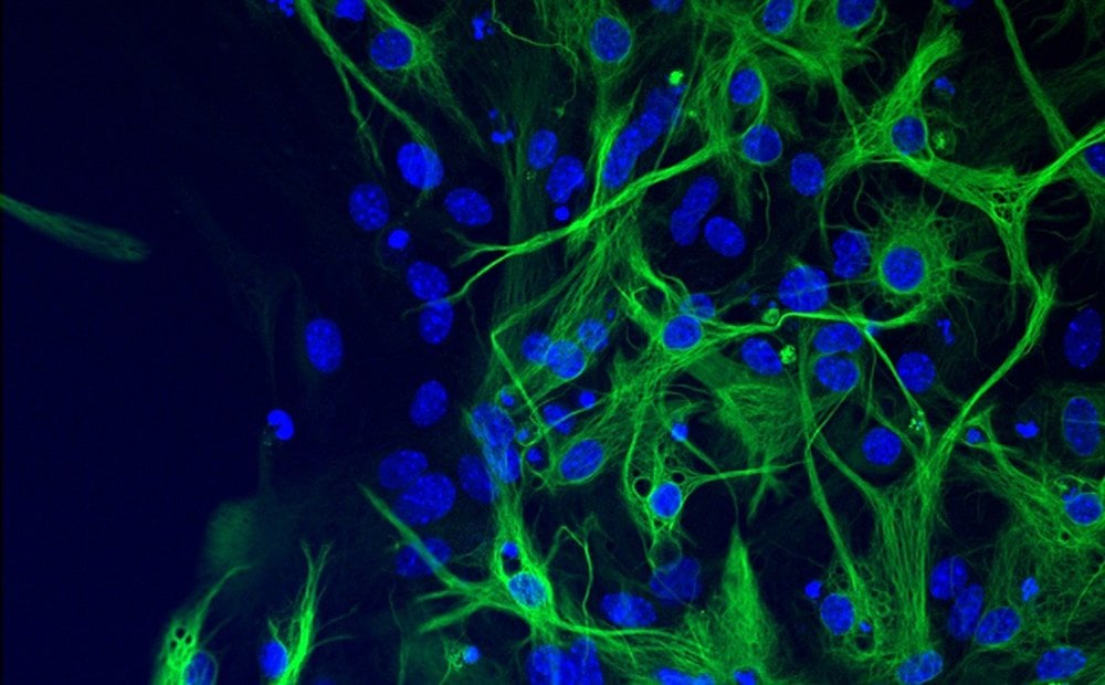 Alzheimer i astrocyty. Czy to stres komórek wyzwala chorobę?