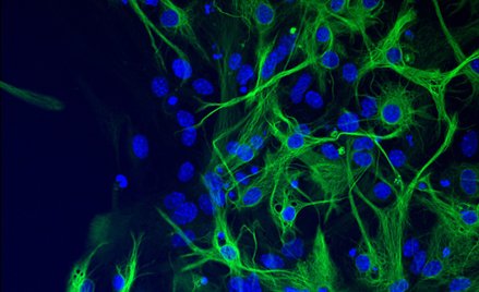 Zdjęcie mikroskopowe astrocytów hodowanych in vitro. Na zielono wyznakowano białko GFAP, na niebiesk