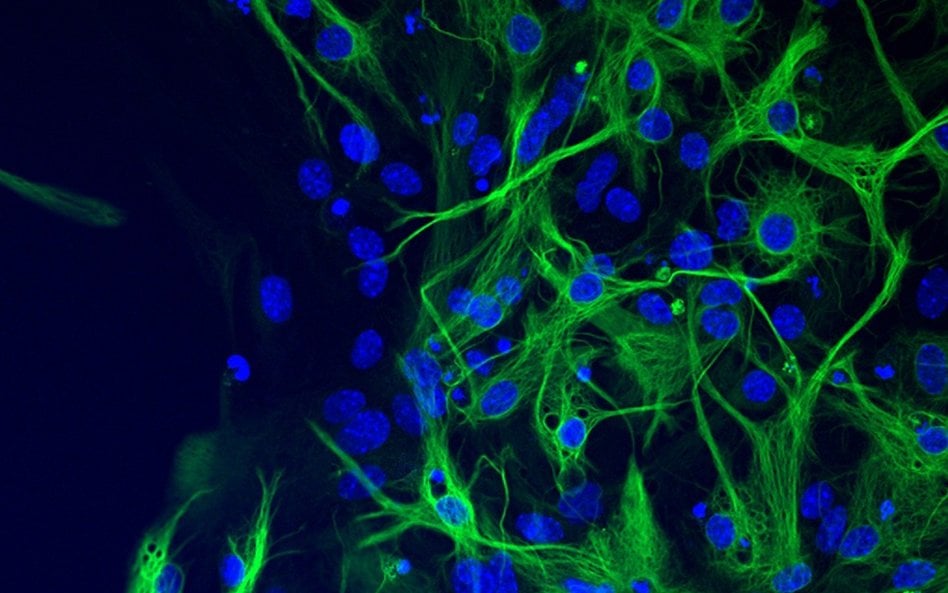 Zdjęcie mikroskopowe astrocytów hodowanych in vitro. Na zielono wyznakowano białko GFAP, na niebiesk