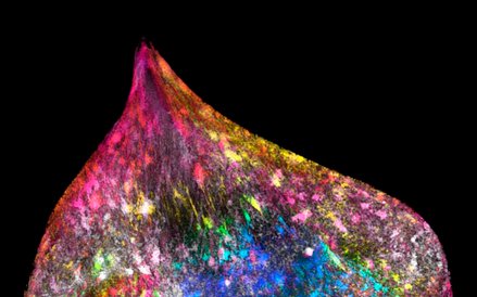 Fot. Ezequiel Miron. Zdjęcie pokazuje komórkę podczas replikacji.