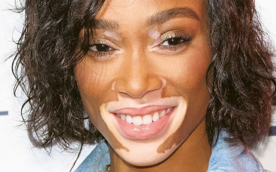 Winnie Harlow, impreza firmy Tommy Hilfiger w Tokio, październik 2018 r.