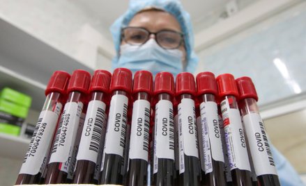 Próbki krwi pobrane od zakażonych