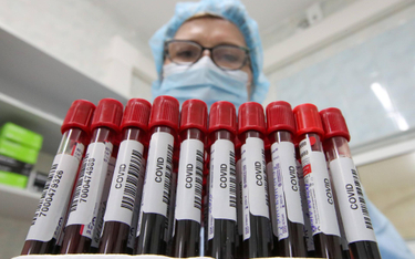 Próbki krwi pobrane od zakażonych