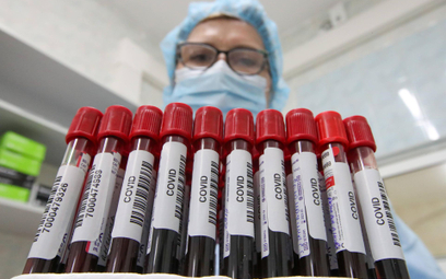 Próbki krwi pobrane od zakażonych