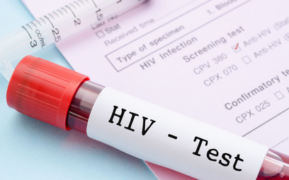 Zalewa nas fala HIV ze Wschodu