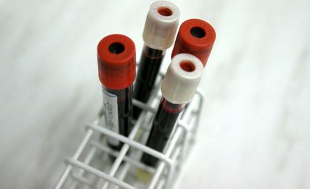 Pacjenci dostają fałszywe wyniki badań laboratoryjnych