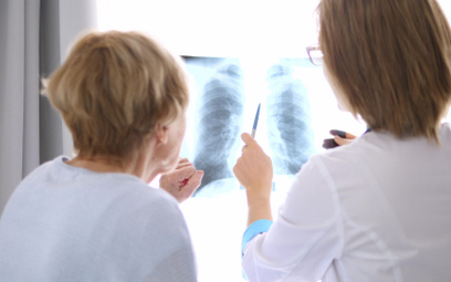 Nowoczesne terapie w raku płuca już od stycznia
