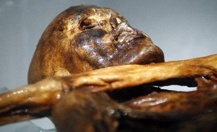 Znalezione w mózgu białka świadczą o tym, że Ötzi przed śmiercią otrzymał cios w głowę
