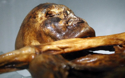 Znalezione w mózgu białka świadczą o tym, że Ötzi przed śmiercią otrzymał cios w głowę