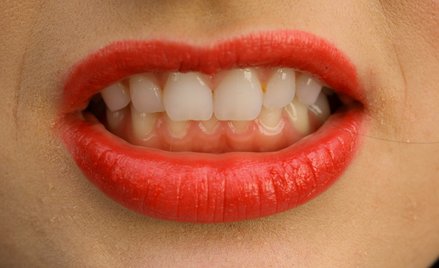 UOKiK stawia zarzuty Dr Smile. "Wywieranie presji i manipulowanie"