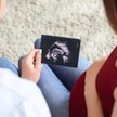 In vitro dla lesbijek. Francja walczy o przyrost naturalny