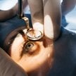 Okuliści ostrzegają przed ryzykiem masowych wyjazdów na leczenie zaćmy za pieniądze z NFZ