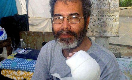 49-letni Franklin Brito stał się symbolem walki z reżimem Hugo Chaveza