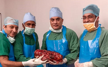 Indie: Pacjentowi usunięto nerkę o wadze siedmiu kilogramów