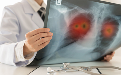 Rak płuca chorobą przewlekłą?