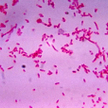 Fusobacterium