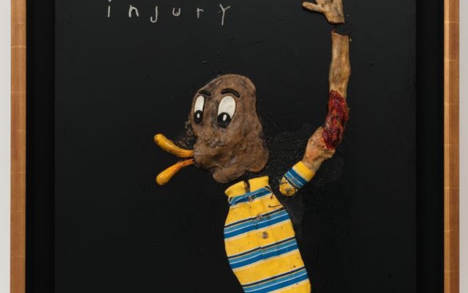 "Duckmans Injury"