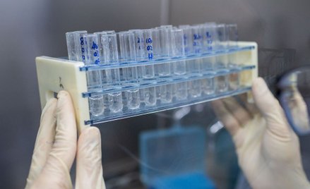 Negatywne wyniki kontroli resortu nauki w NCBR