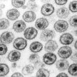 Lekarze potwierdzają: Druga osoba na świecie wyleczona z wirusa HIV
