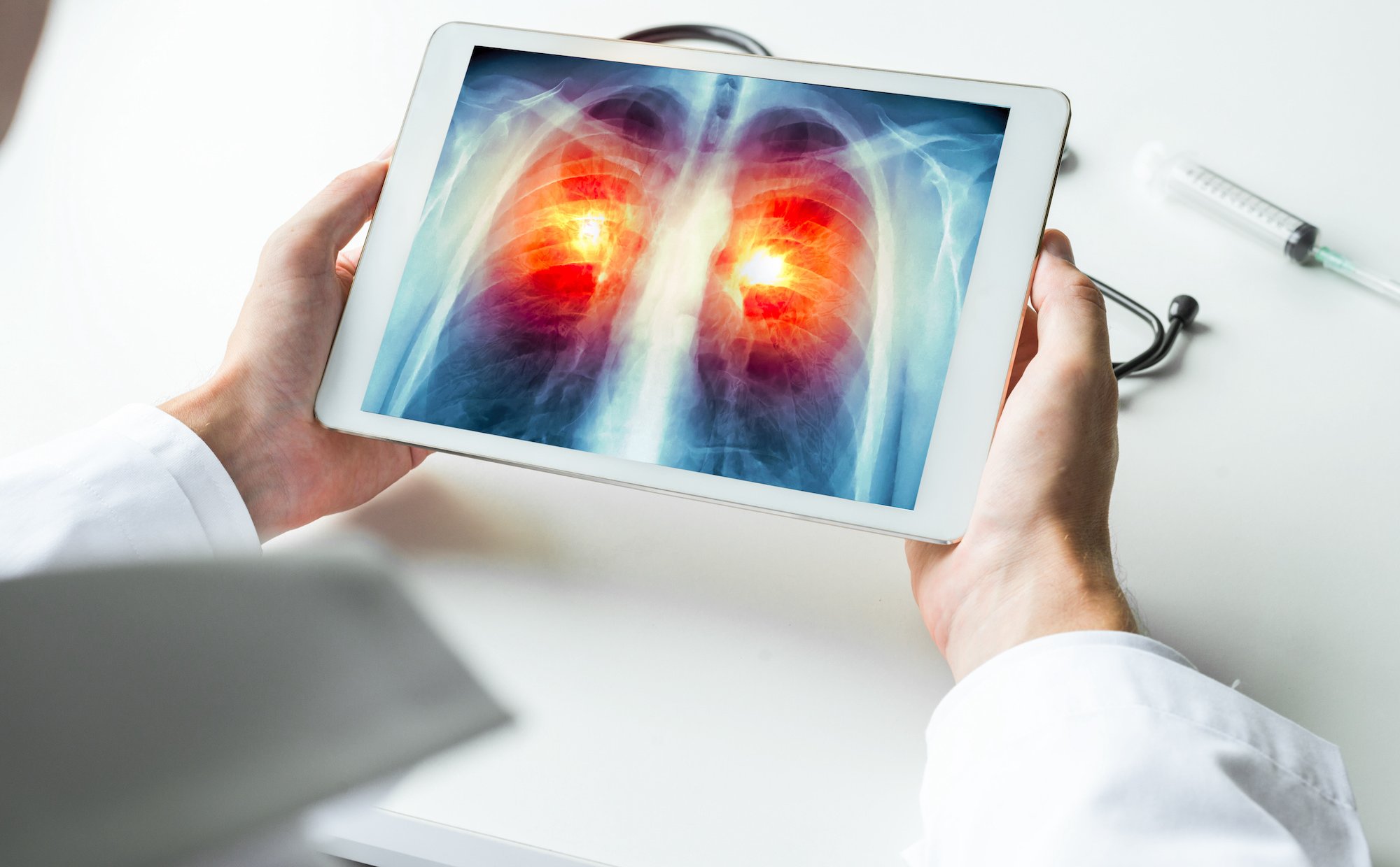 Po latach zaniedbań pulmonologia przechodzi dużą reformę