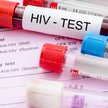 W Polsce osoby niepełnoletnie nie mogą wykonać diagnostyki w kierunku HIV bez zgody rodziców bądź op
