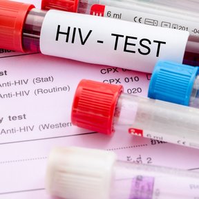 W Polsce osoby niepełnoletnie nie mogą wykonać diagnostyki w kierunku HIV bez zgody rodziców bądź op