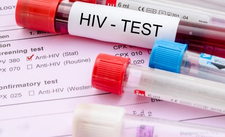 W Polsce osoby niepełnoletnie nie mogą wykonać diagnostyki w kierunku HIV bez zgody rodziców bądź op
