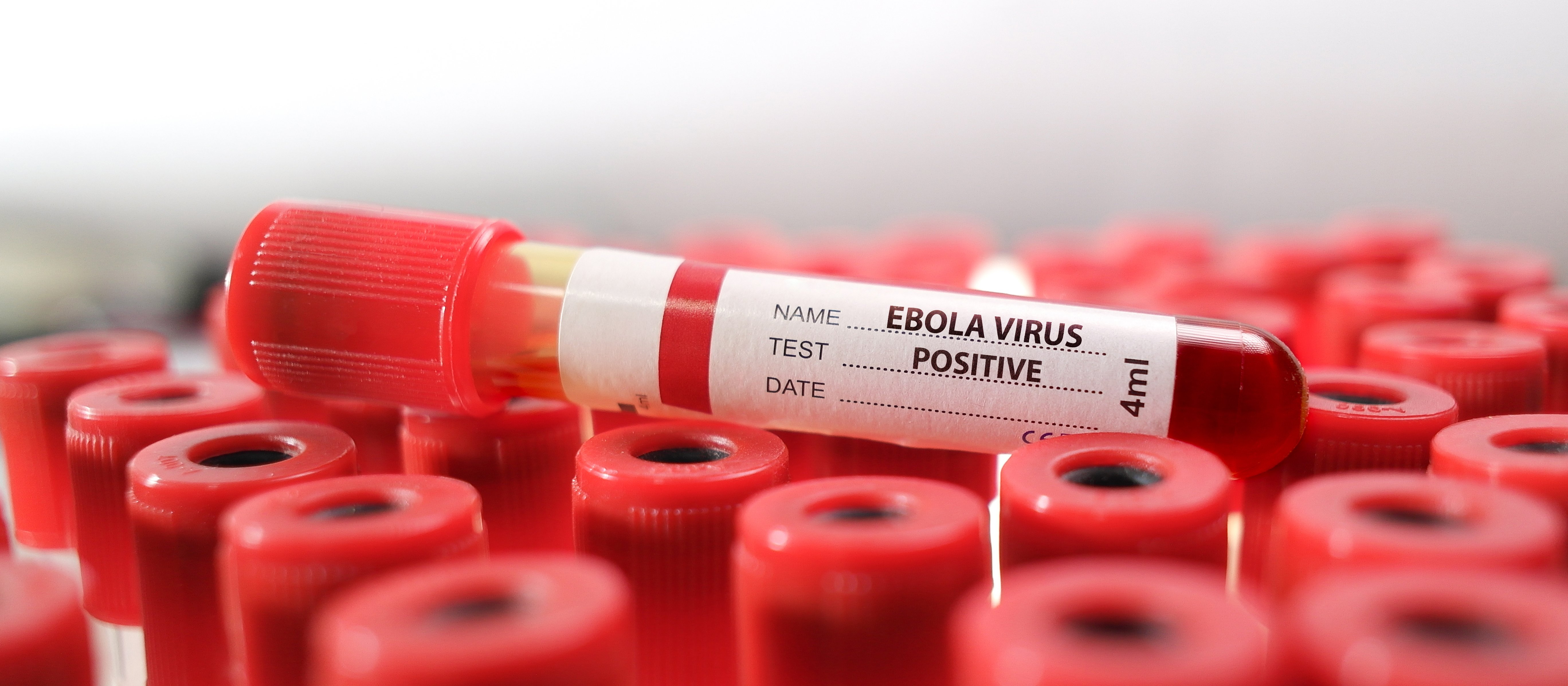 Dane WHO o epidemii eboli w Afryce. Setki zakażeń i rosnący bilans ofiar