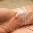 Śmiertelność piorunującej sepsy meningokokowej leczonej nawet w najlepszych światowych ośrodkach prz