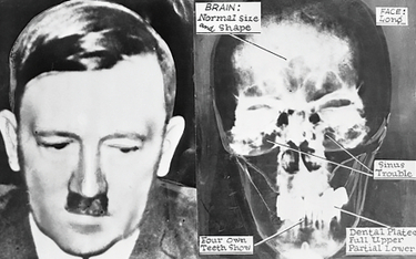 Zdjęcie rentgenowskie głowy Hitlera wykonane 20 lipca 1944 r. przez otolaryngologa prof. Erwina Gies