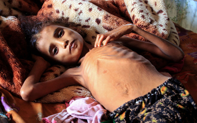 400 tysięcy dzieci w Jemenie może w tym roku umrzeć z głodu