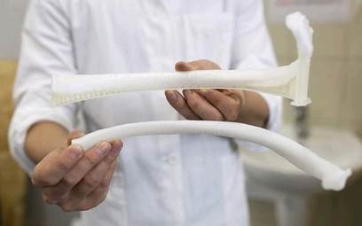 Implant żebra wyprodukowany na drukarce polskiej firmy 3DGence wszczepiono pacjentowi w Bułgarii
