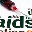 Młoda kobieta wyleczona z AIDS