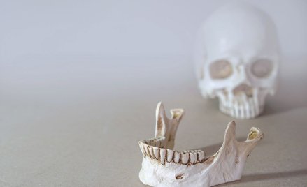 Żuchwa jak na dłoni