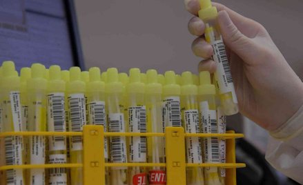 Korea Płd.: Eksperymentalna terapia chorych na COVID-19 będzie testowana na ludziach