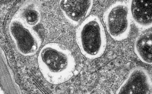 Alphaproteobacteria. Źródło: Louisa Howard – Dartmouth Electron Microscope Facility /The Encyclopedi