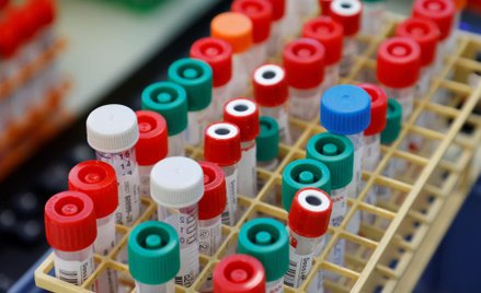 Scope Fluidics: Panel na koronawirusa rozwija się