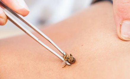 Hiszpania: Kobieta zmarła po terapii polegającej na żądleniu